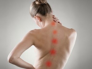 scoliosis